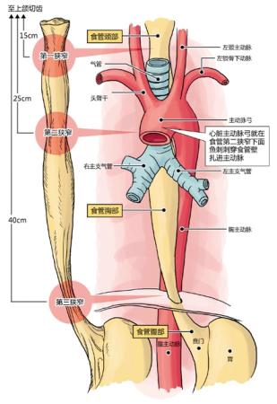 主动脉弓缩窄分型图片图片